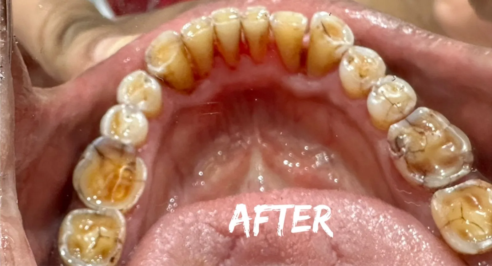 After: Front view, Case 3 · Check-ups & Cleaning